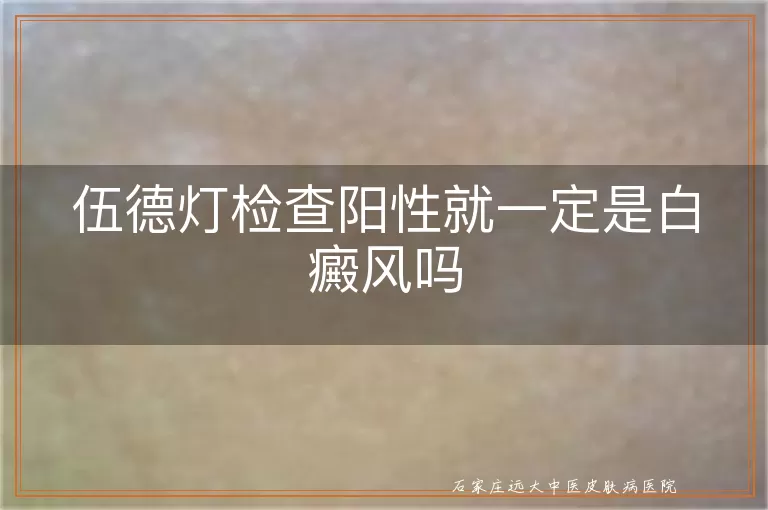 伍德灯检查阳性就一定是白癜风吗