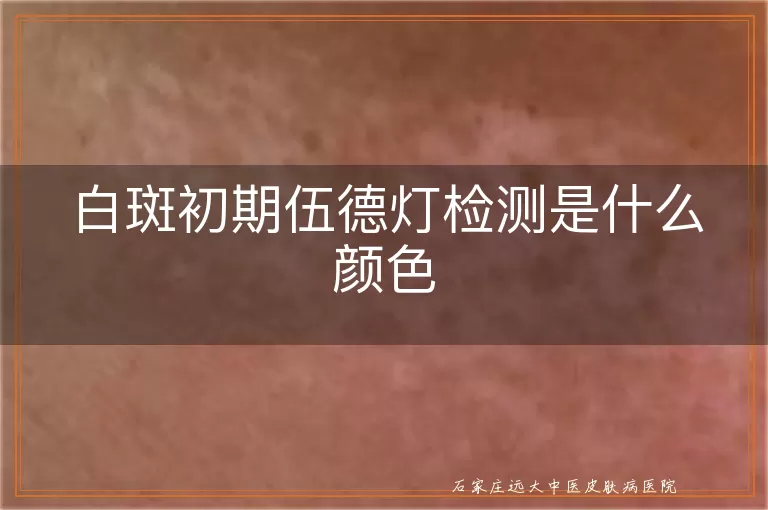 白斑初期伍德灯检测是什么颜色