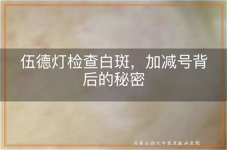 伍德灯检查白斑，加减号背后的秘密