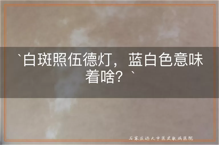白斑照伍德灯，蓝白色意味着啥？