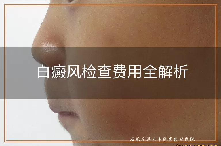 白癜风检查费用全解析