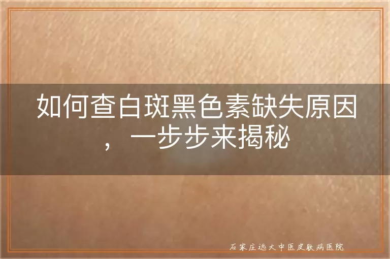 如何查白斑黑色素缺失原因，一步步来揭秘