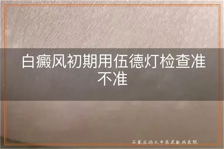 白癜风初期用伍德灯检查准不准