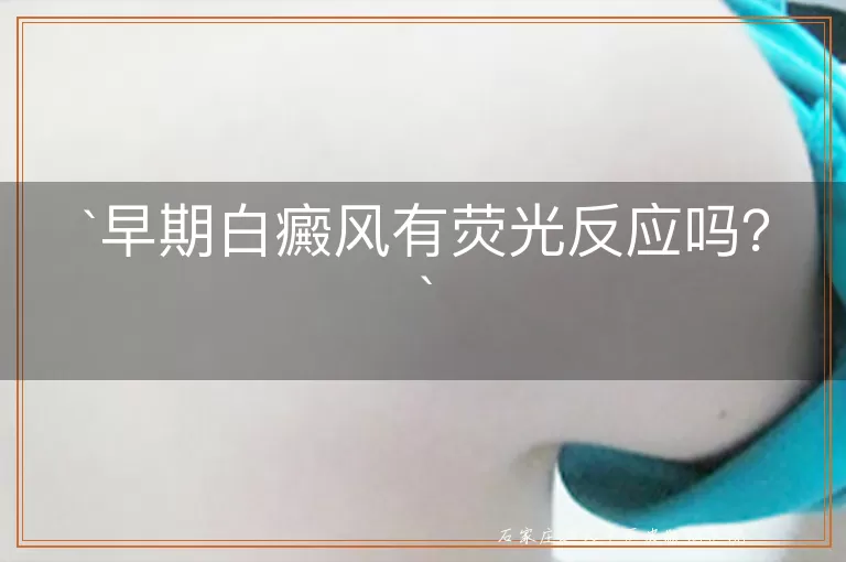 早期白癜风有荧光反应吗？