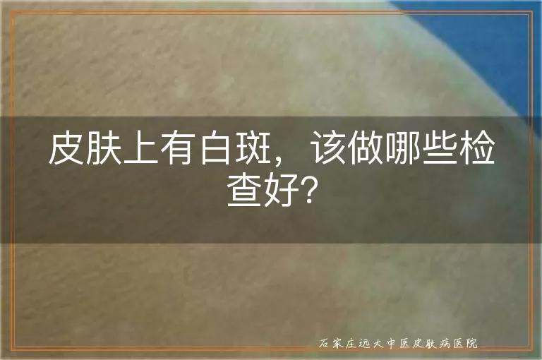 皮肤上有白斑，该做哪些检查好？