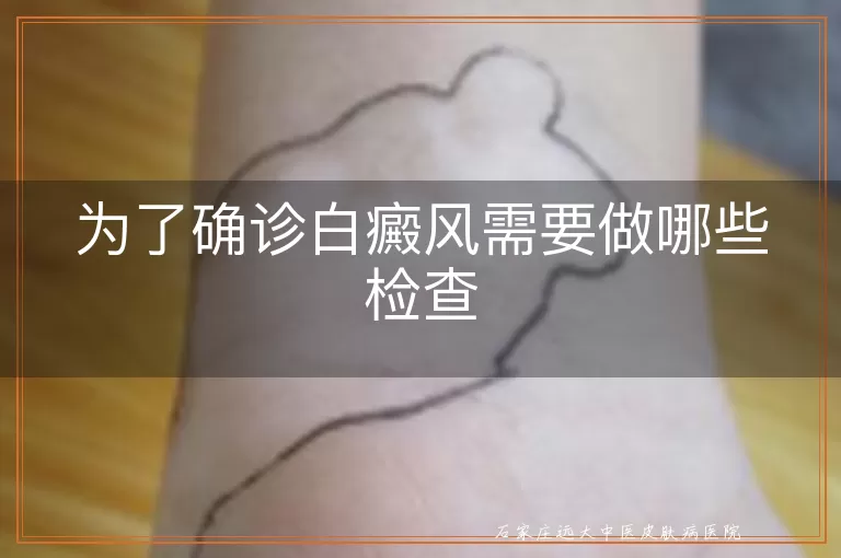 为了确诊白癜风需要做哪些检查