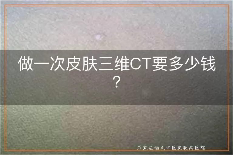 做一次皮肤三维CT要多少钱？