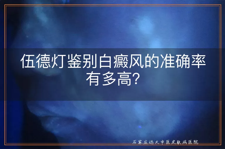 伍德灯鉴别白癜风的准确率有多高？