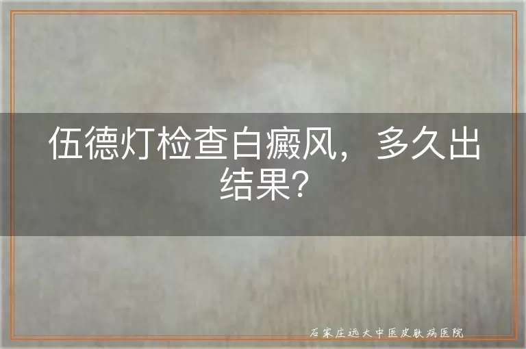 伍德灯检查白癜风，多久出结果？