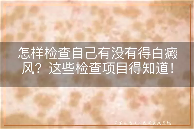 怎样检查自己有没有得白癜风？这些检查项目得知道！
