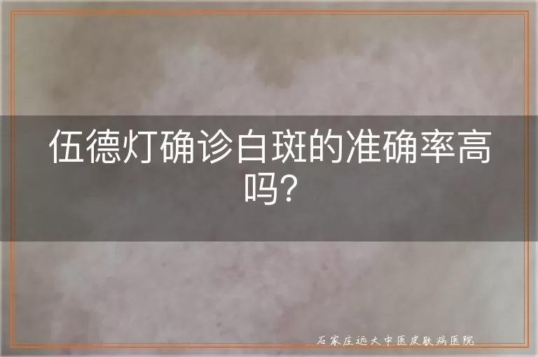 伍德灯确诊白斑的准确率高吗？