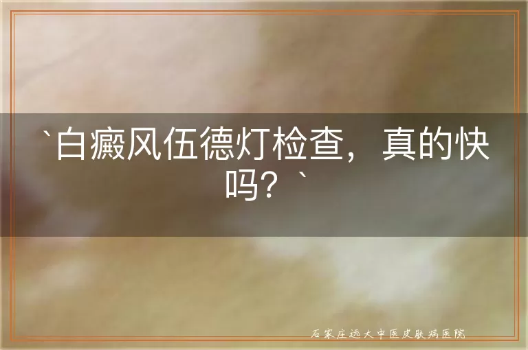 白癜风伍德灯检查，真的快吗？
