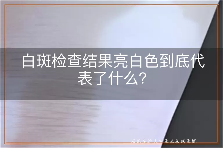 白斑检查结果亮白色到底代表了什么？