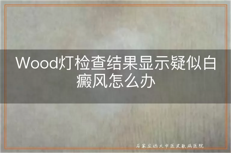Wood灯检查结果显示疑似白癜风怎么办