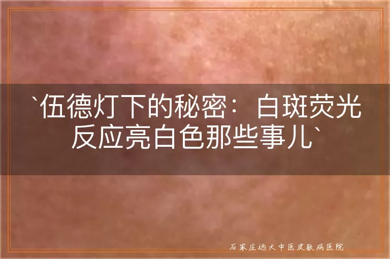 伍德灯下的秘密：白斑荧光反应亮白色那些事儿