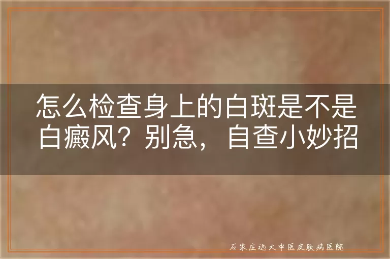 怎么检查身上的白斑是不是白癜风？别急，自查小妙招来啦！