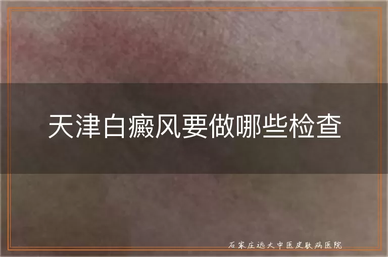 天津白癜风要做哪些检查