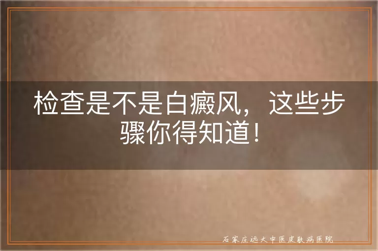 检查是不是白癜风，这些步骤你得知道！