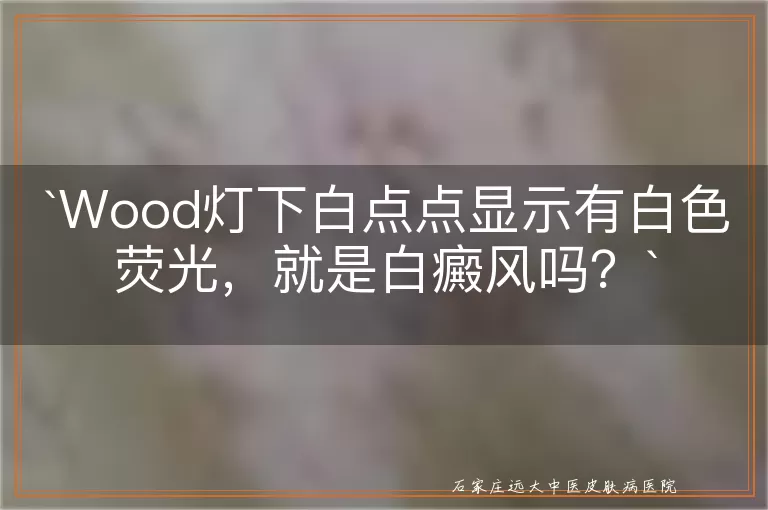 Wood灯下白点点显示有白色荧光，就是白癜风吗？