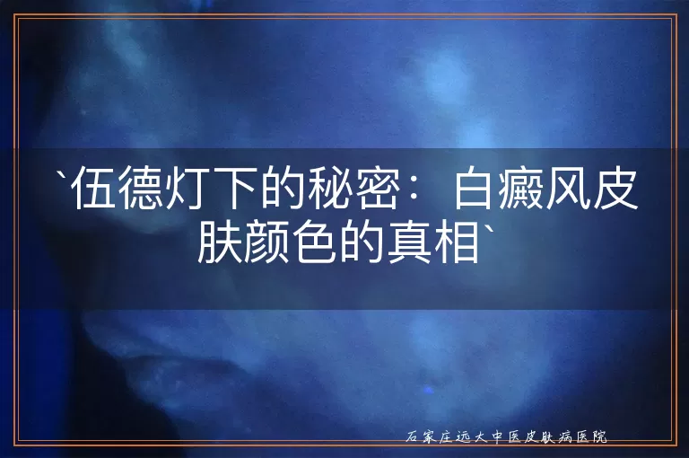 伍德灯下的秘密：白癜风皮肤颜色的真相
