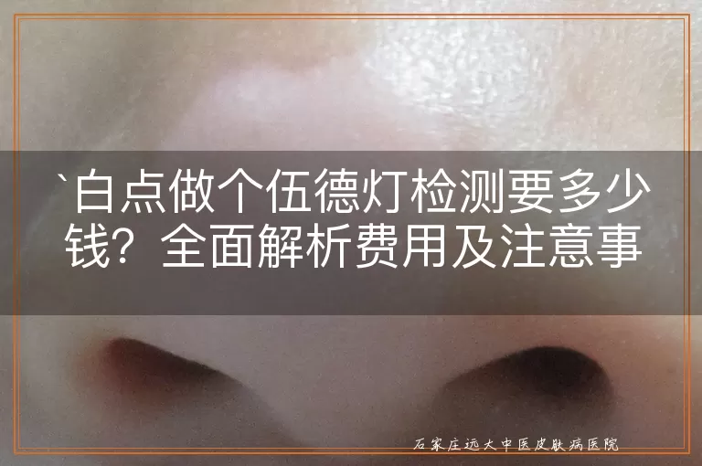 白点做个伍德灯检测要多少钱？全面解析费用及注意事项