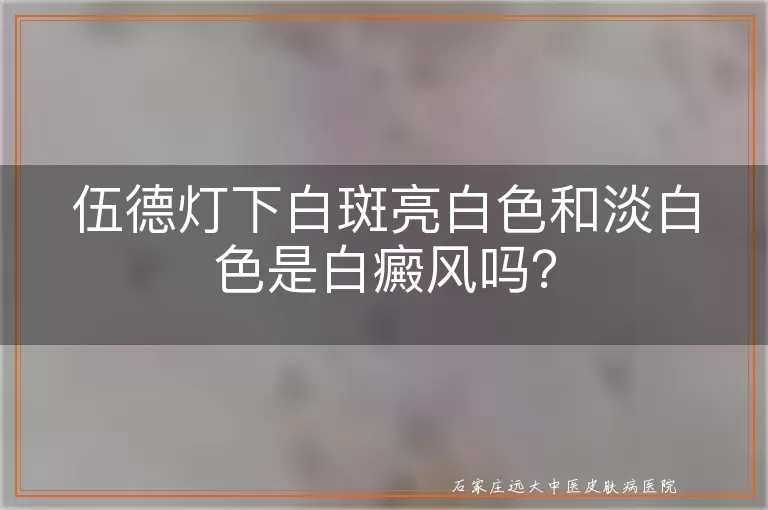 伍德灯下白斑亮白色和淡白色是白癜风吗？