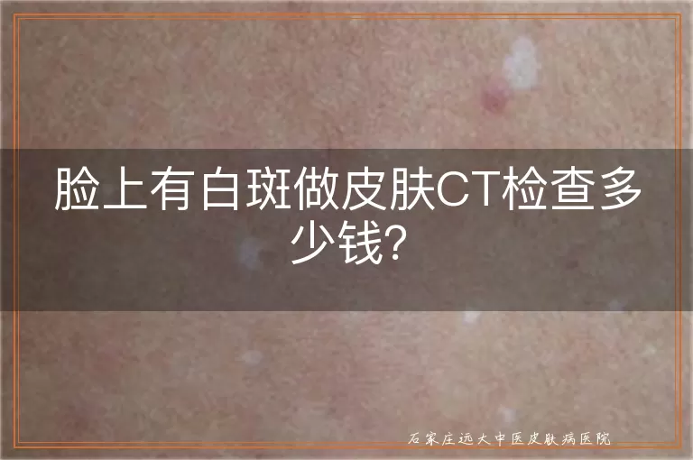 脸上有白斑做皮肤CT检查多少钱？
