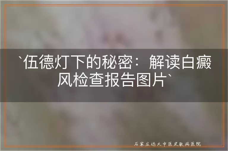伍德灯下的秘密：解读白癜风检查报告图片
