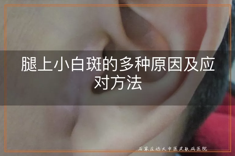 腿上小白斑的多种原因及应对方法