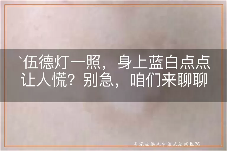 伍德灯一照，身上蓝白点点让人慌？别急，咱们来聊聊！