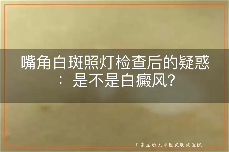 嘴角白斑照灯检查后的疑惑：是不是白癜风？