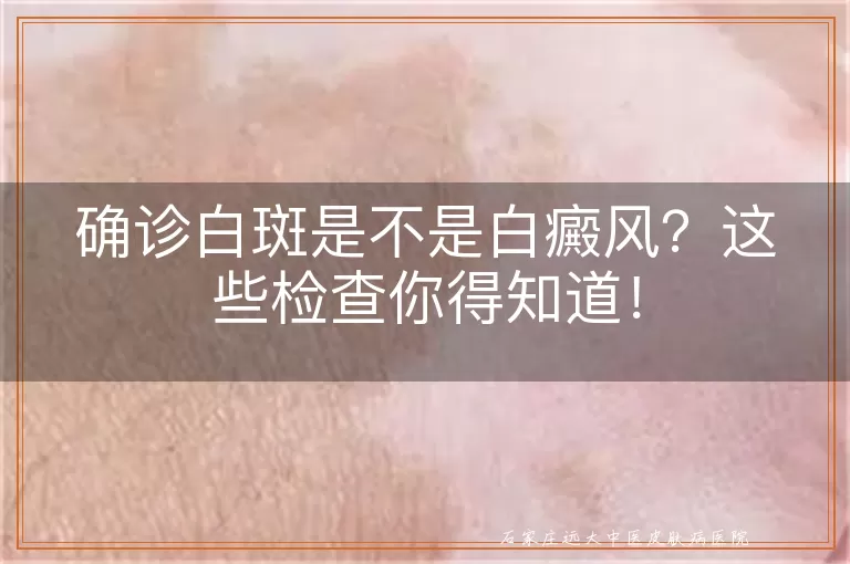确诊白斑是不是白癜风？这些检查你得知道！