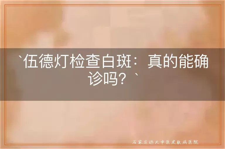 伍德灯检查白斑：真的能确诊吗？