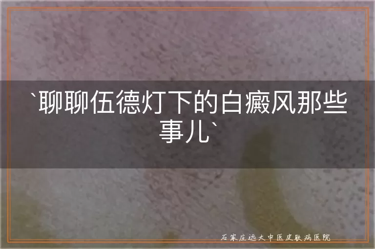 聊聊伍德灯下的白癜风那些事儿