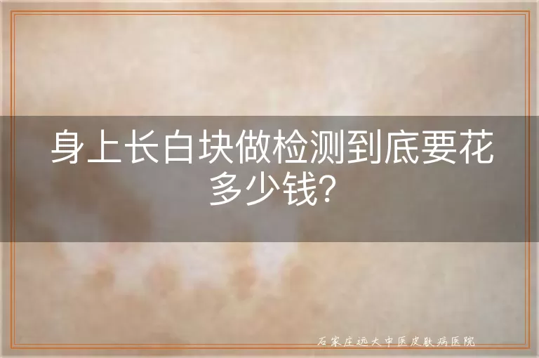 身上长白块做检测到底要花多少钱？