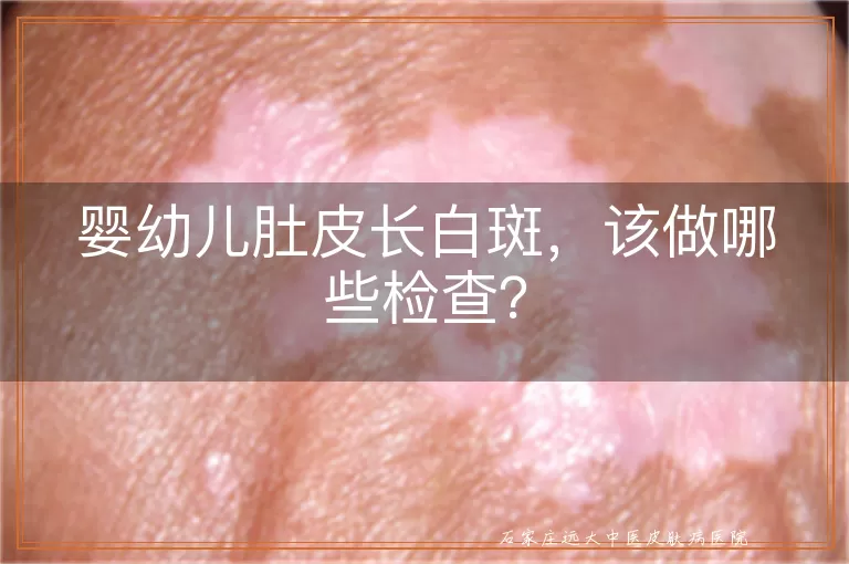婴幼儿肚皮长白斑，该做哪些检查？