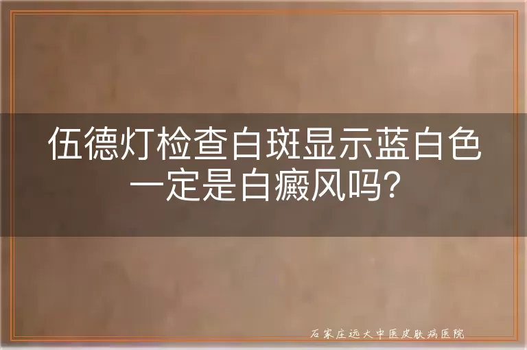 伍德灯检查白斑显示蓝白色一定是白癜风吗？