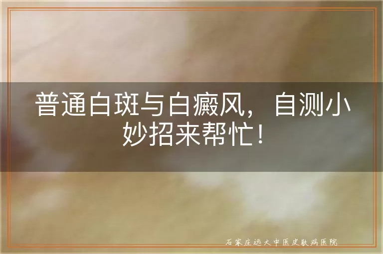 普通白斑与白癜风，自测小妙招来帮忙！