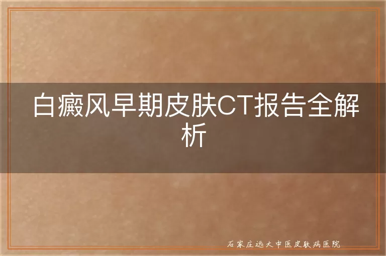 白癜风早期皮肤CT报告全解析