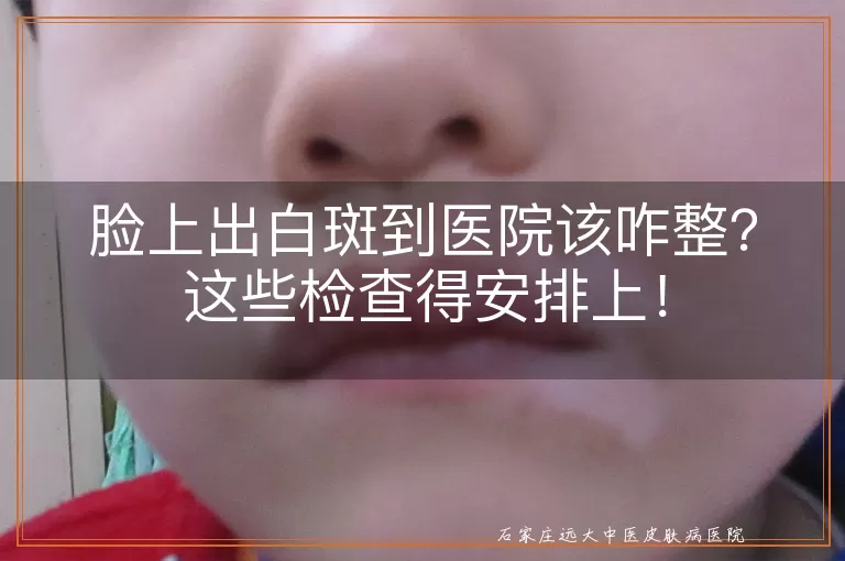 脸上出白斑到医院该咋整？这些检查得安排上！