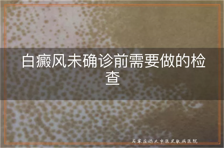 白癜风未确诊前需要做的检查