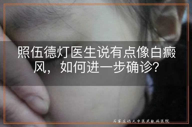 照伍德灯医生说有点像白癜风，如何进一步确诊？