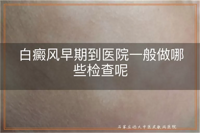 白癜风早期到医院一般做哪些检查呢