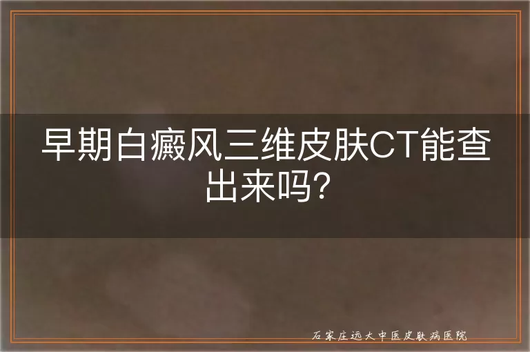 早期白癜风三维皮肤CT能查出来吗？