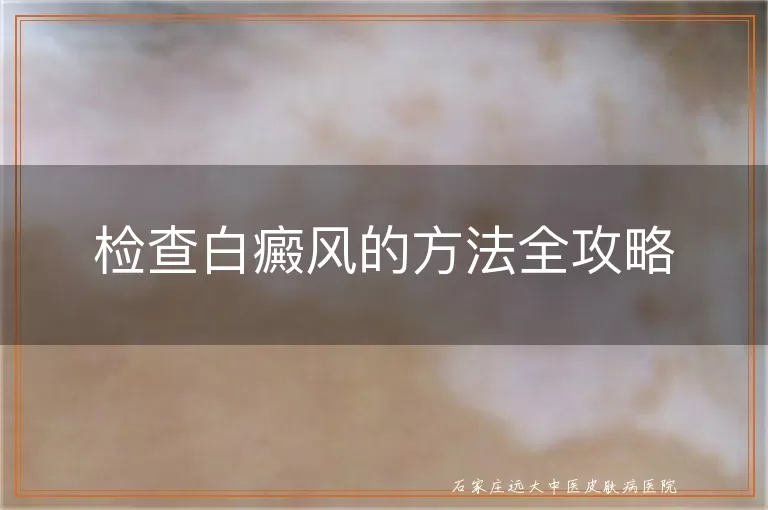 检查白癜风的方法全攻略