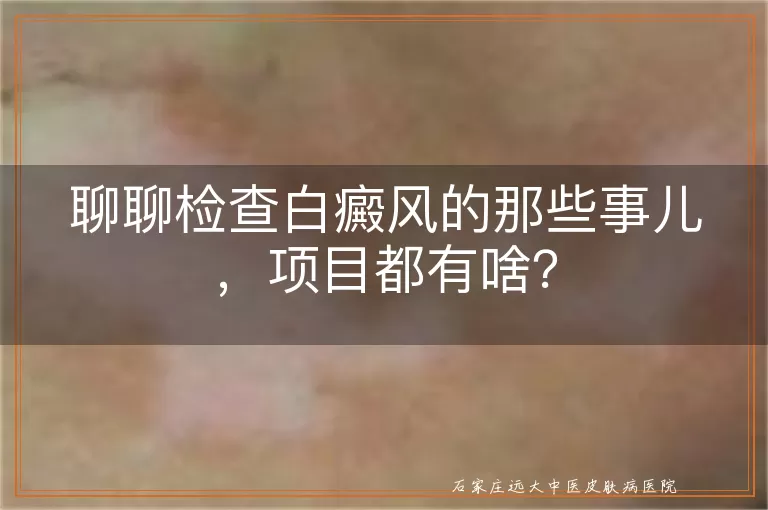 聊聊检查白癜风的那些事儿，项目都有啥？
