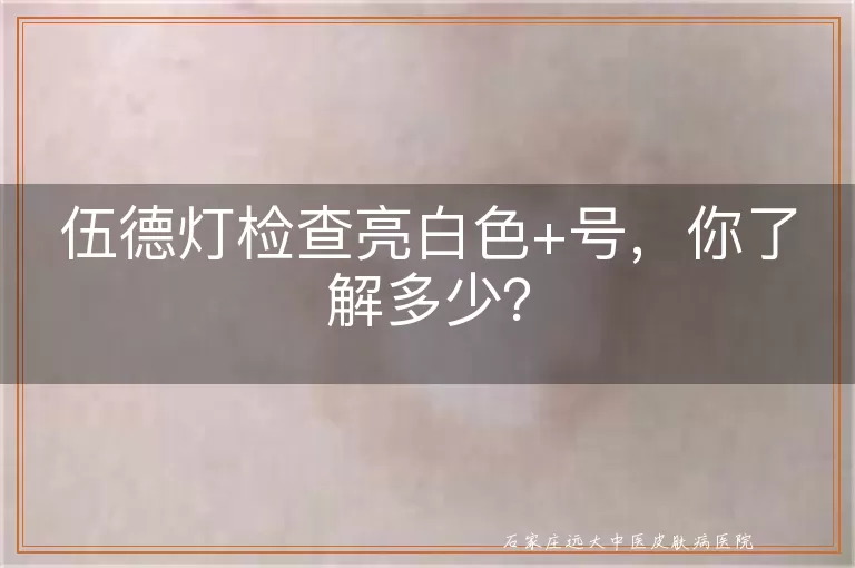 伍德灯检查亮白色+号，你了解多少？