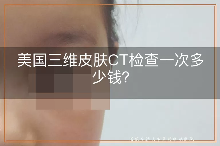 美国三维皮肤CT检查一次多少钱？
