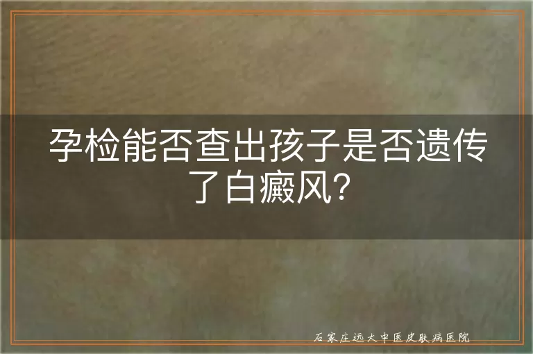 孕检能否查出孩子是否遗传了白癜风？