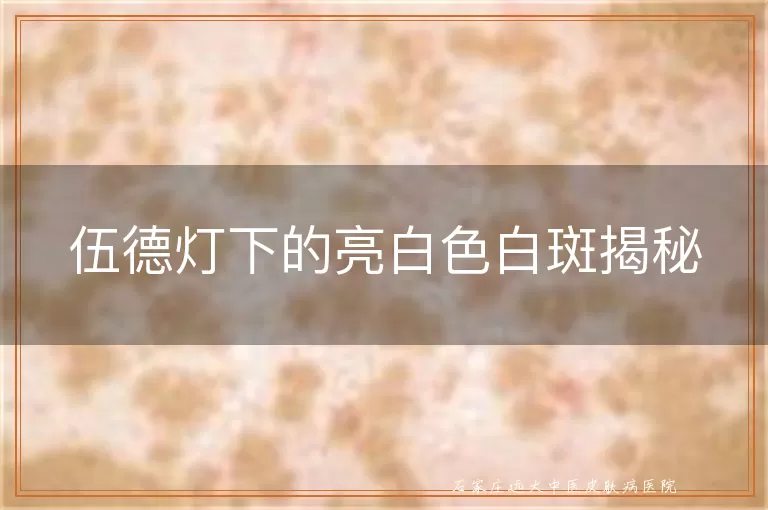 伍德灯下的亮白色白斑揭秘